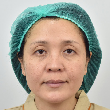 Before Facelift surgery